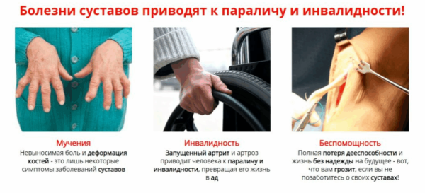 Монастырская травница — мазь для лечения суставов Монастырская травница — мазь для лечения суставов