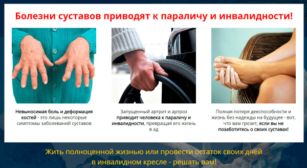 Artox для здоровья суставов
Artox для здоровья суставов