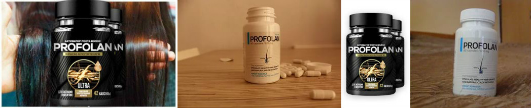 Profolan: Комплексный обзор капсул для укрепления волос и стимуляции их роста — Фото 5