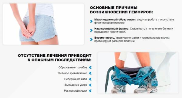 Hemora — крем от геморроя
Hemora — крем от геморроя