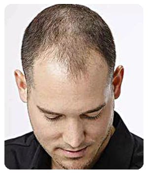 
				Vihair			
