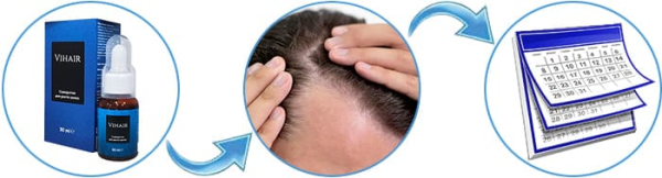 
				Vihair			