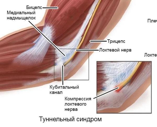 
				Артекс &mdash; капсулы для суставов в России			